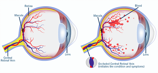 Structure of the eye image