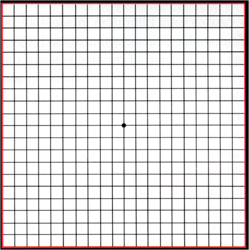 Amsler Grid Test - California Retina