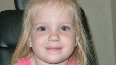 Child after eye muscle surgery
