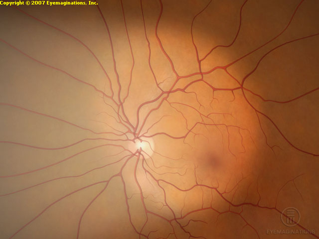 Normal retina image