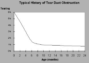 History of tear duct obstruction image