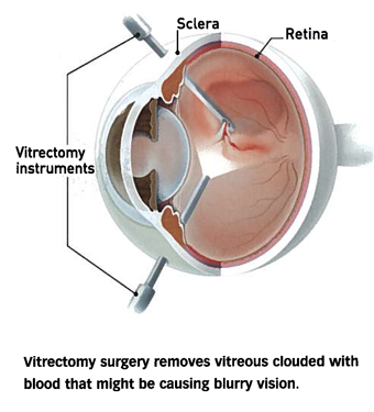 Eye structure image