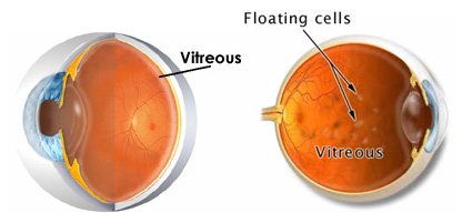 Structure of the eye image